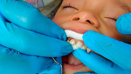 Dentista para niños