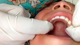 Dentista para niños